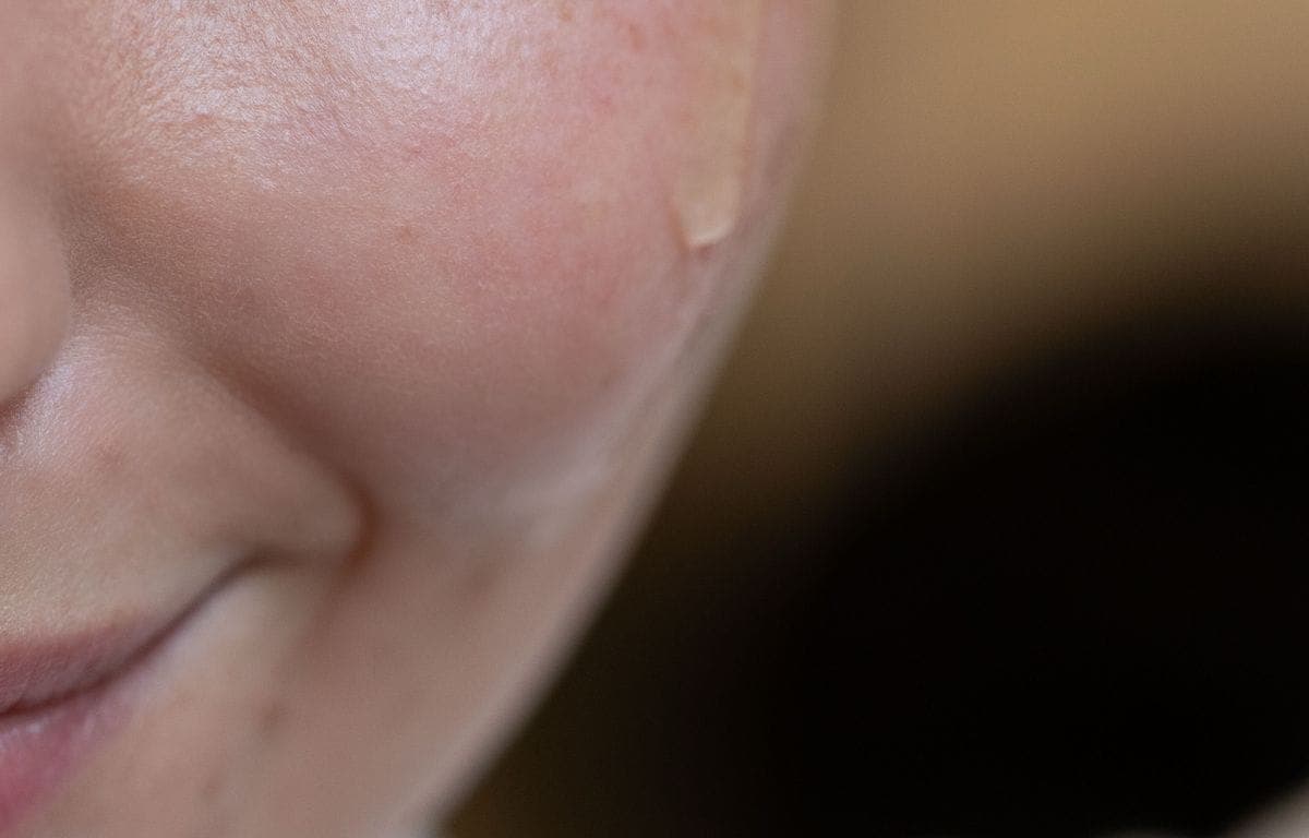 Bakuchiol vs peptides for early fine lines